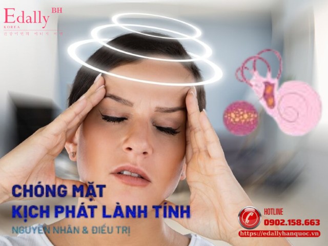 Hội chứng chóng mặt kịch phát tư thế lành tính - Nguyên nhân, triệu chứng và cách điều trị