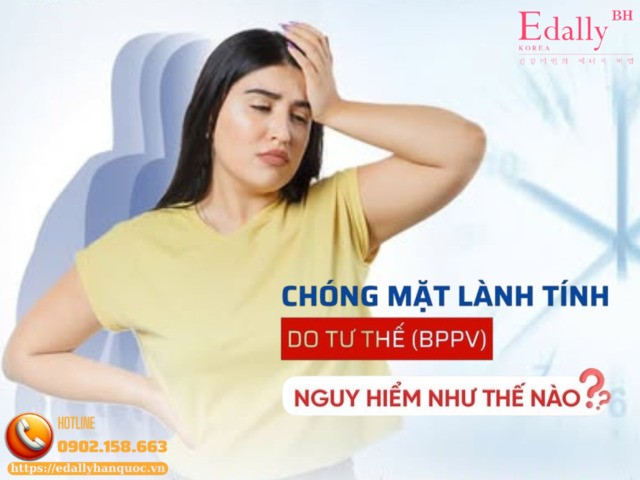 Chóng Mặt Lành Tính Do Tư Thế Có Nguy Hiểm Không?