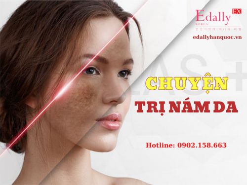 Chuyện Trị Nám Da - Những Điều Cần Biết Về Nám Da