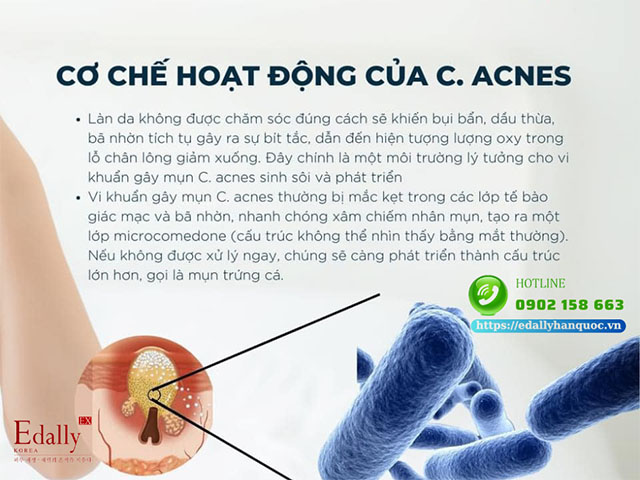 Phân loại vi khuẩn gây mụn C.acnes