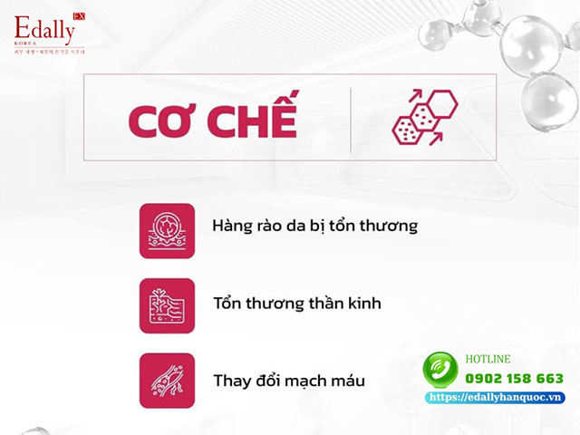 Cơ chế bệnh sinh của làn da nhạy cảm