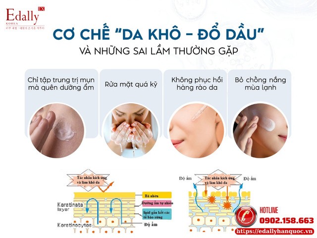 Cơ chế da khô - đổ dầu - nổi mụn và những sai lầm thường gặp Cơ chế da khô - đổ dầu - nổi mụn và những sai lầm thường gặp