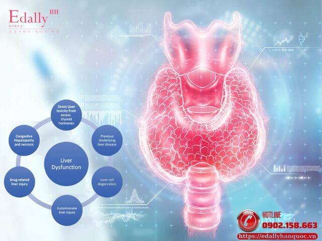 Ảnh: Cơ chế gây rối loạn chức năng gan ở bệnh nhân cường giáp