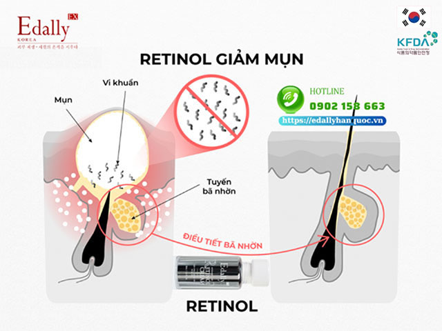 Cơ chế goạt động của hoạt chất Retinol trong quá trình điều trị mụn