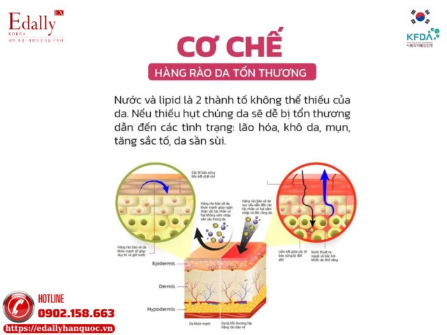 Cơ chế khiến hàng rào bảo vệ da bị tổn thương và suy yếu