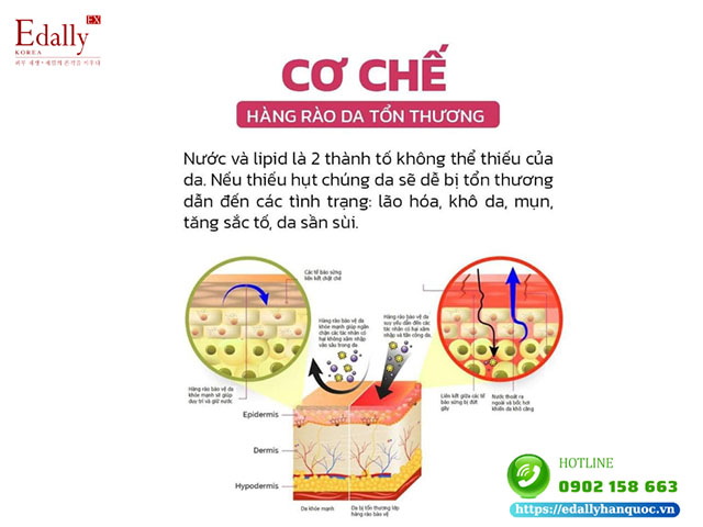 Cơ chế khiến hàng rào da bị tổn thương