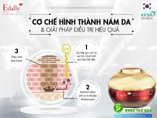 Cơ chế hình thành nám da