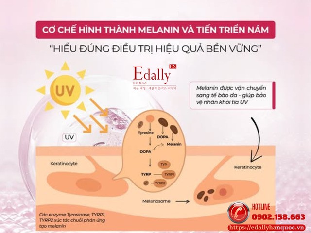 Cơ chế hình thành melanin và tiến triển nám da - Hiểu đúng để điều trị hiệu quả bền vững