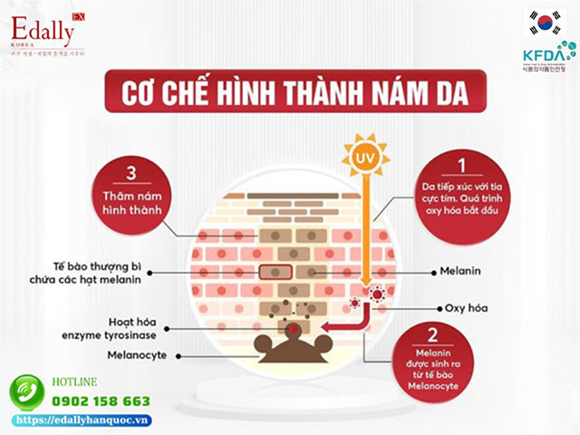 Cơ chế hình thành nám da