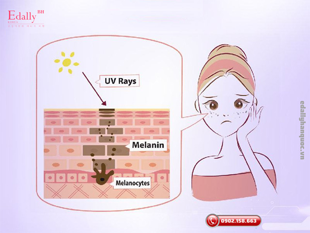 Cơ chế hình thành sắc tố Melanin trên da