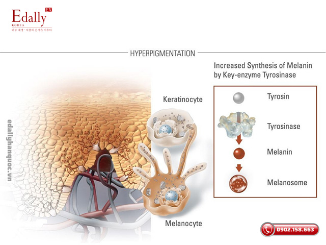 Cơ chế sản sinh sắc tố melanin trên da