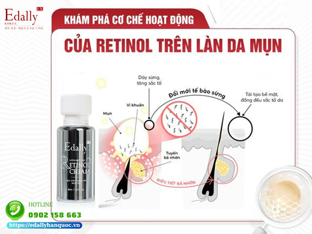 Cơ chế hoạt động của Retinol trên làn da mụn