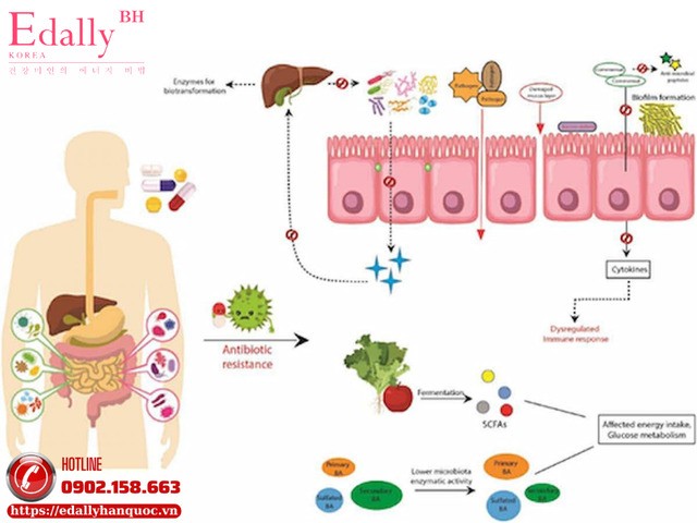 Cơ chế đường ruột bẩn gây ra các bệnh mạn tính
