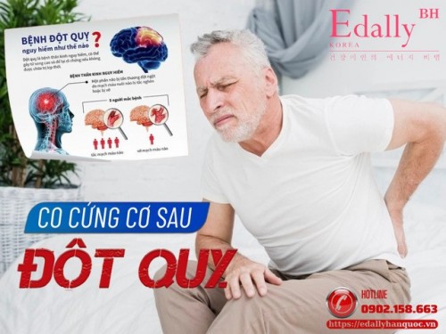 Co Cứng Sau Đột Quỵ Não (Post Stroke Spasticity)