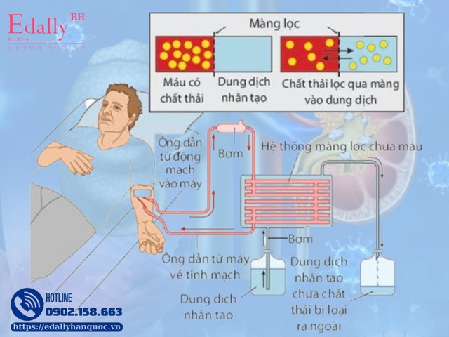 Có phải bệnh thận mạn khi hết giai đoạn có thể điều trị bảo tồn là bế tắc hoàn toàn không?
