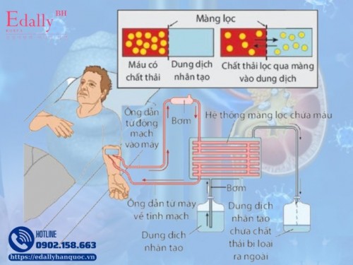 Có Phải Bệnh Thận Mạn Khi Hết Giai Đoạn Có Thể Điều Trị Bảo Tồn Là Bế Tắc Hoàn Toàn Không?