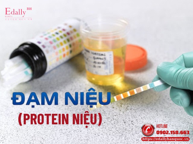Phân loại protein niệu - không phải cứ có tiểu đạm là bệnh thận