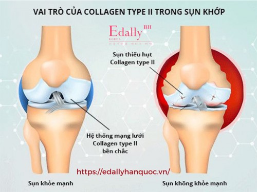 Collagen Có Tác Dụng Gì Với Xương Khớp?