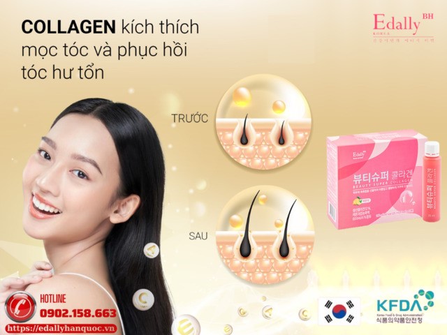 Nước uống Beauty Super Collagen Edally Hàn Quốc - Bí quyết cho làn da và mái tóc khỏe từ bên trong