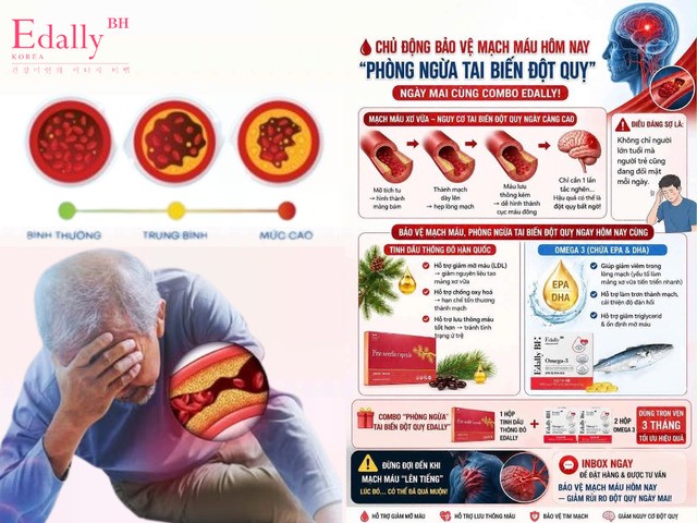 Combo Edally - Chặn đứng vòng luẩn quẩn nguy hiểm: mỡ máu - huyết áp - đột quỵ từ gốc