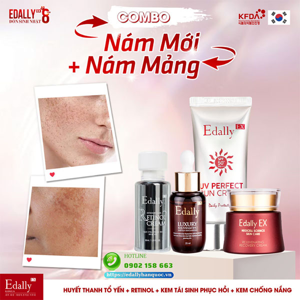 Combo cải thiện nám mới, nám mảng sau khi peel da