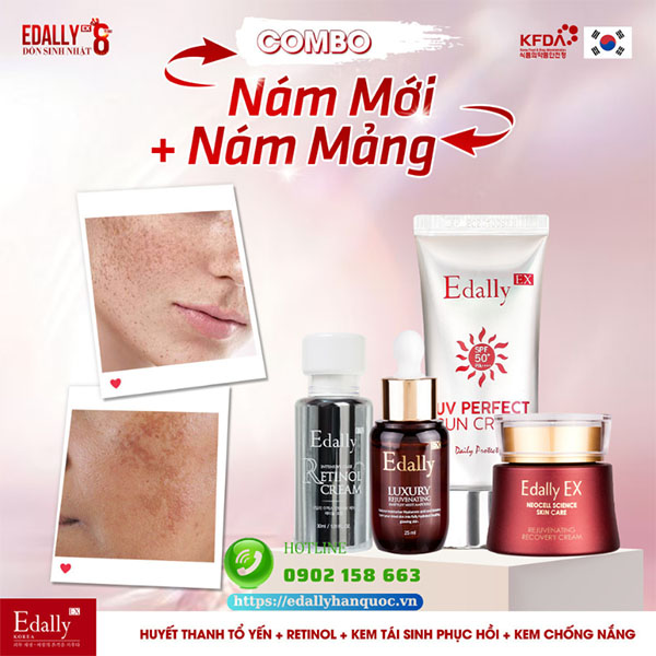 Combo trị nám mới và nám mảng