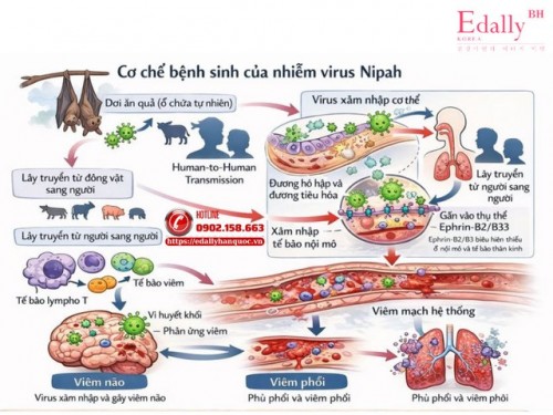 Virus Nipah Lây Nhiễm Như Thế Nào Và Làm Sao Để Phòng Ngừa, Kiểm Soát Hiệu Quả?