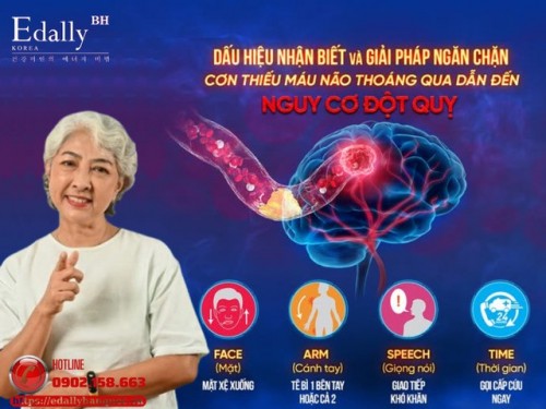 Cơn Thiếu Máu Não Thoáng Qua (TIA): Dấu Hiệu Nhẹ Nhưng Cảnh Báo Nguy Cơ Đột Quỵ Não