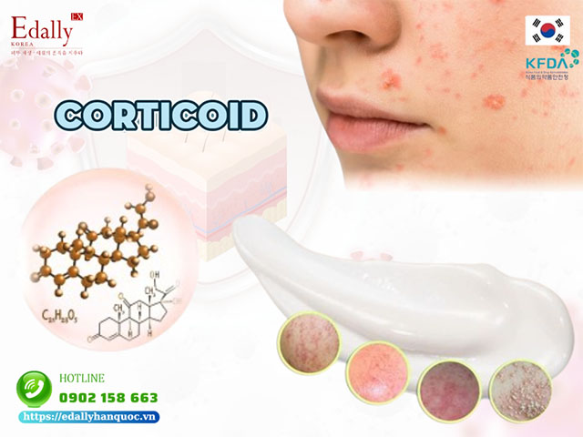 Corticoid trong da liễu và những điều cần biết để phục hồi da hiệu quả