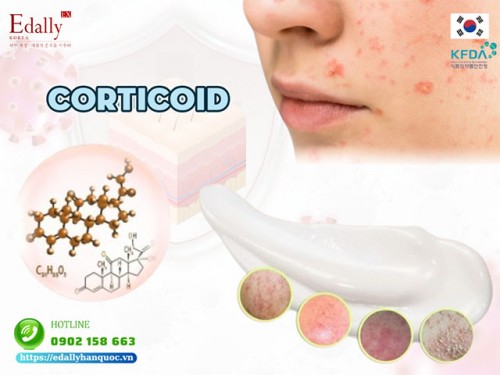 Corticoid Trong Da Liễu Và Những Điều Cần Biết