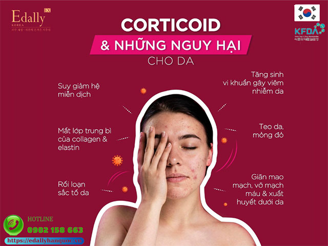 Corticoid và những nguy hại cho làn da