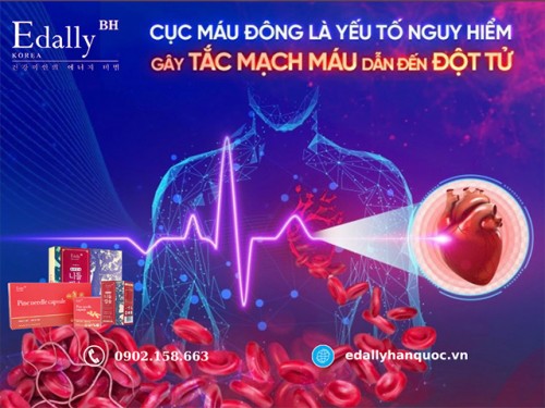 Cục Máu Đông Là Yếu Tố Nguy Hiểm Gây Tắc Mạch Máu Dẫn Đến Đột Tử