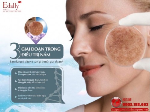 3 Giai Đoạn Vàng Trong Điều Trị Nám Da Và Giải Pháp Toàn Diện