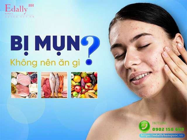 Da bị mụn không nên ăn gì?