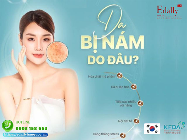 Da bị nám sạm là do đâu?