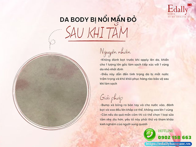 Da body bị nổi mẩn đỏ sau khi làm sạch bằng sữa tắm