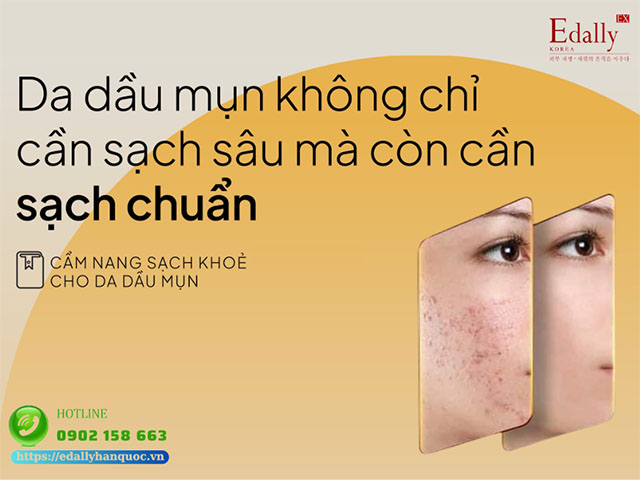 Da dầu mụn không chỉ cần sạch sâu mà còn cần sạch chuẩn