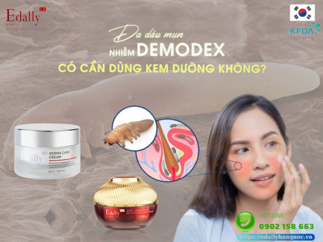 Làn da dầu mụn, nhiễm demodex có cần dùng kem dưỡng ẩm không?