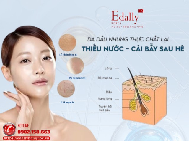 Da dầu nhưng thực chất lại thiếu nước - Cái bẫy sau mùa hè nắng nóng
