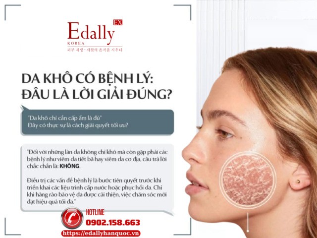 Da Khô Có Bệnh Lý: Đâu Là Lời Giải Đúng?