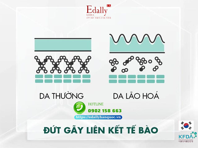 Da khô lão hóa nhanh hơn da dầu do sự đứt gãy liên kết tế bào bên trong da