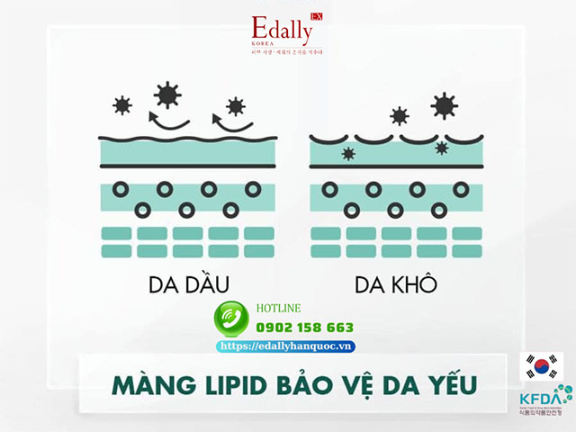 Da khô lão hóa nhanh hơn da dầu do lớp màng lipid bảo vệ da yếu