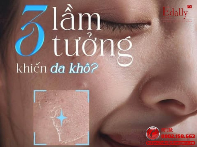 Da khô nẻ mùa lạnh: 3 lầm tưởng tai hại khiến da càng khô, càng mệt mỏi Da khô nẻ mùa lạnh: 3 lầm tưởng tai hại khiến da càng khô, càng mệt mỏi