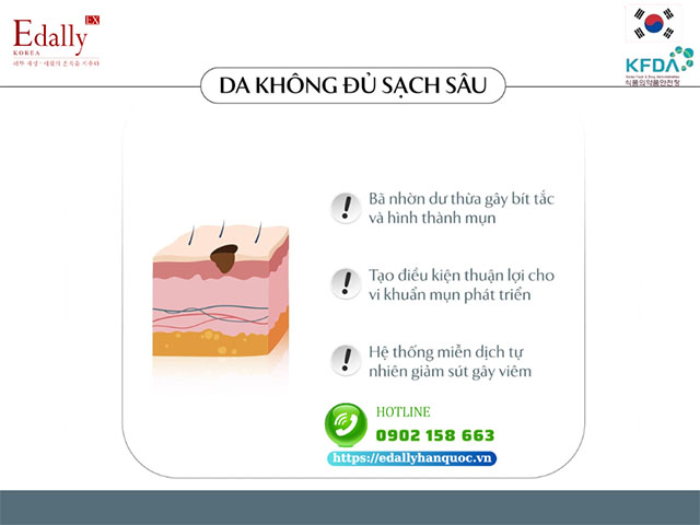 Da không đủ sạch sâu khi làm sạch khiến mụn tái đi tái lại