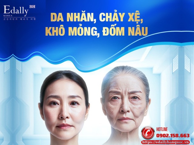 Da nhăn, chảy xệ, khô mỏng, đốm nâu là những dấu hiệu lão hóa của cơ thể thường bị bỏ qua