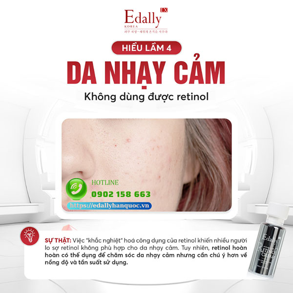 Có phải da nhay cảm không dùng được Retinol?