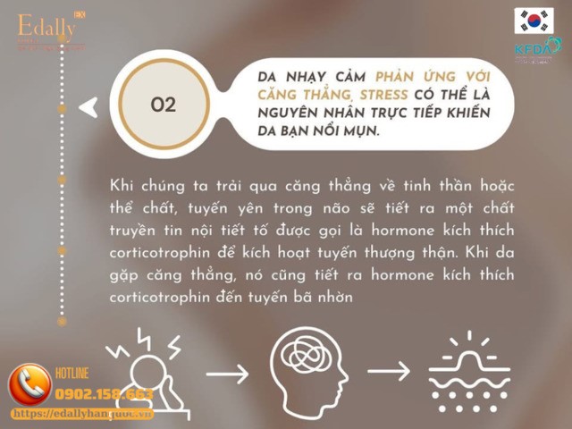 Da nhạy cảm phản ứng với căng thẳng, stress là nguyên nhân mụn mãn tính