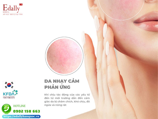 Da nhạy cảm phản ứng là gì?