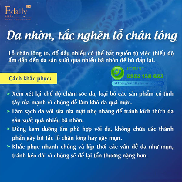 Cách khắc phục tình trạng da nhờn, tắc nghẽn lỗ chân lông do mất cân bằng da như thế nào?