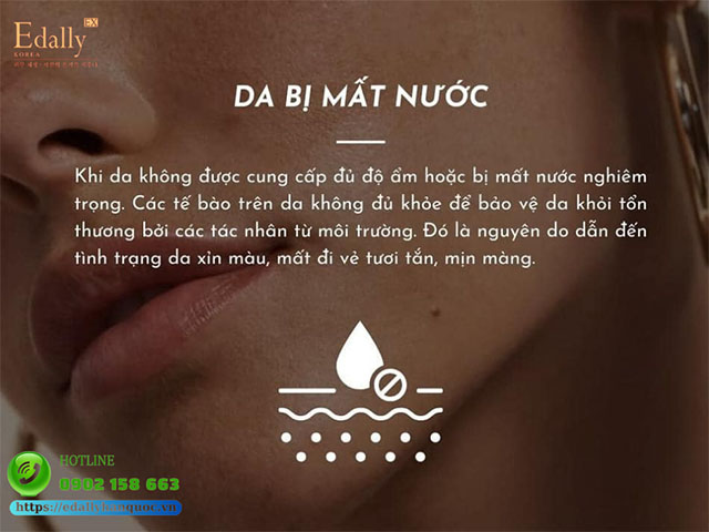 Da sạm xỉn màu do da bị mất nước